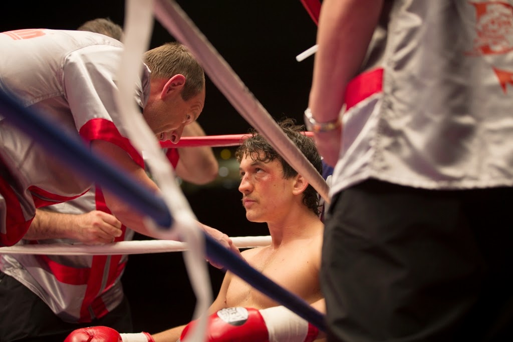 Oscar2016Bleedforthis